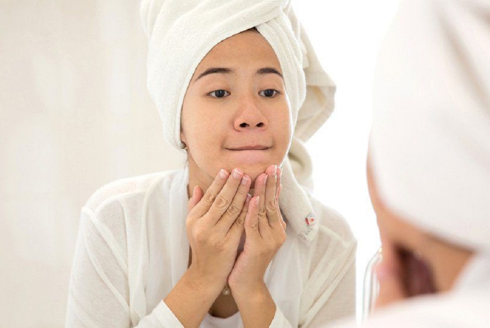 6 remèdes contre l’acné étonnamment efficaces pour les adolescentes