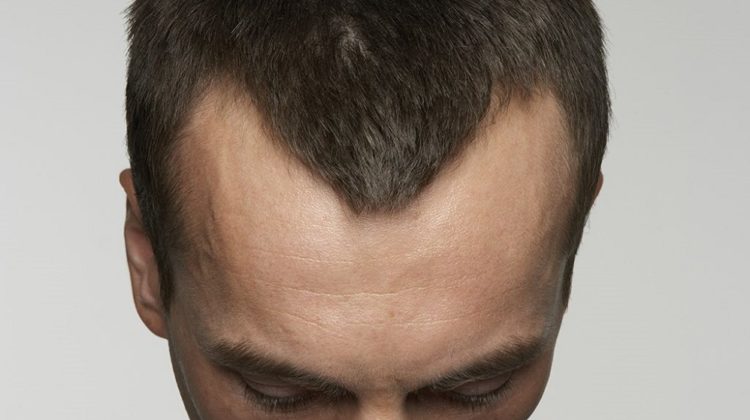 22 conseils pour vous aider à conserver vos cheveux