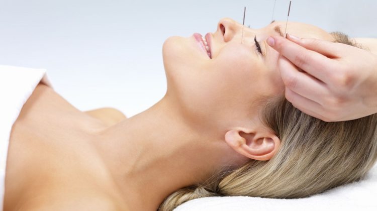 L'acupuncture pour les problèmes de sinus